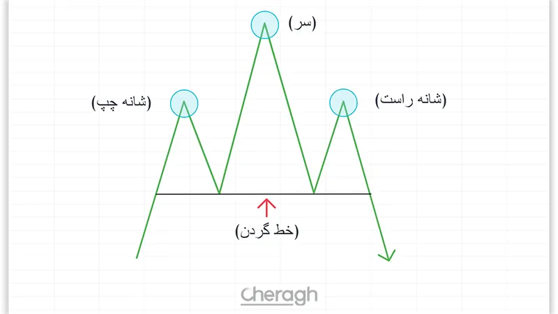 سر و شانه سقف